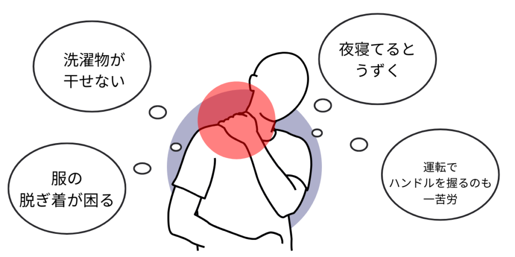 肩の痛み方の例